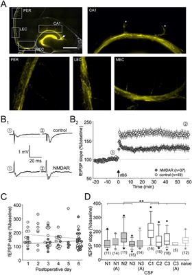 Novel Object Recognition in Rats With NMDAR Dysfunction in CA1 After Stereotactic Injection of Anti-NMDAR Encephalitis Cerebrospinal Fluid